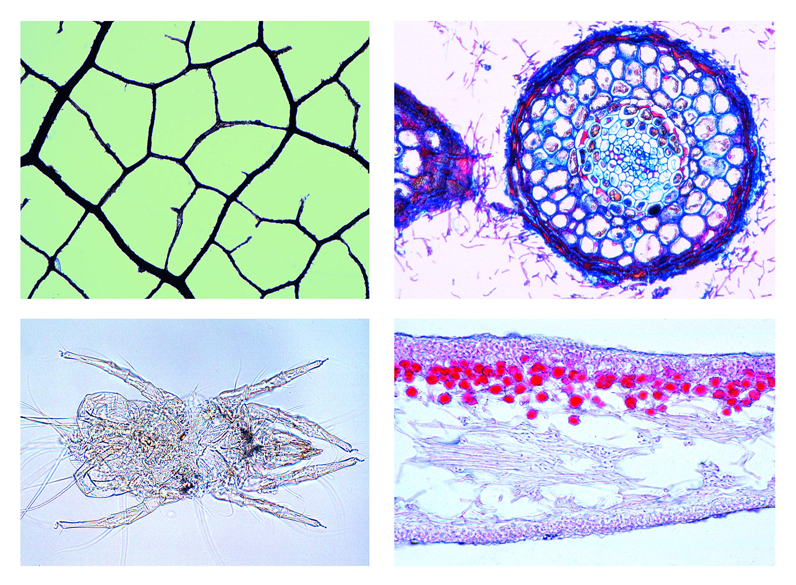 3B Scientific Biology Microscopy Micropräparate Series_ Environment II: Water: Water pollution