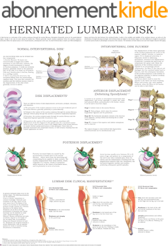 Download Herniated Lumbar Disk - Quick Reference Chart: Full illustrated (English Edition) PDF