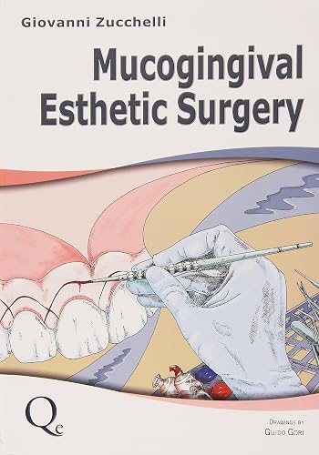 Download Mucogingival Esthetic Surgery PDF