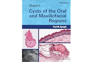Shear's Cysts of the Oral and Maxillofacial Regions