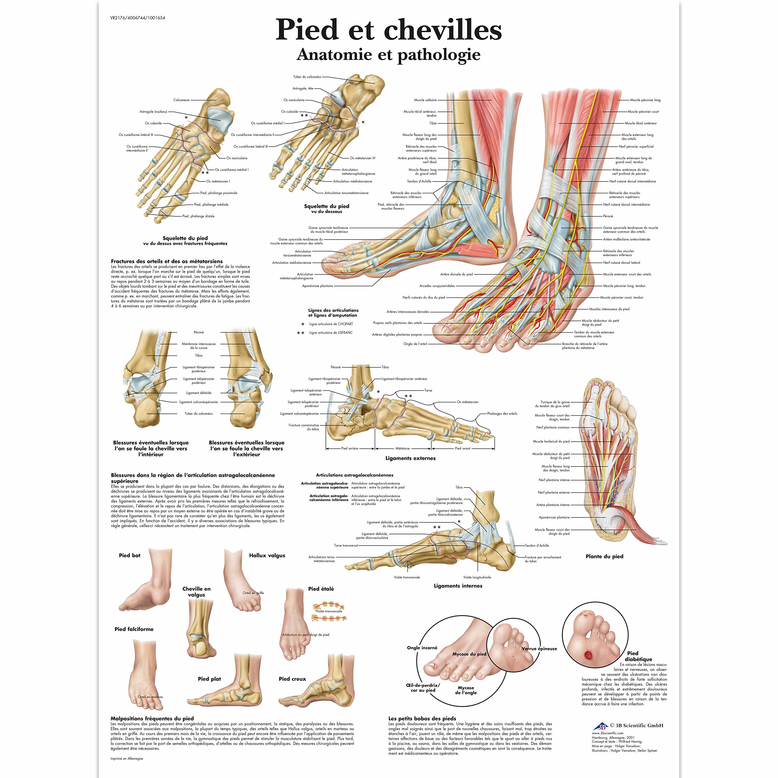 3B Scientific VR2176UU Anatomical Chart "Pied et Chevilles - Anatomie et Pathologie", Paper Version — image 1