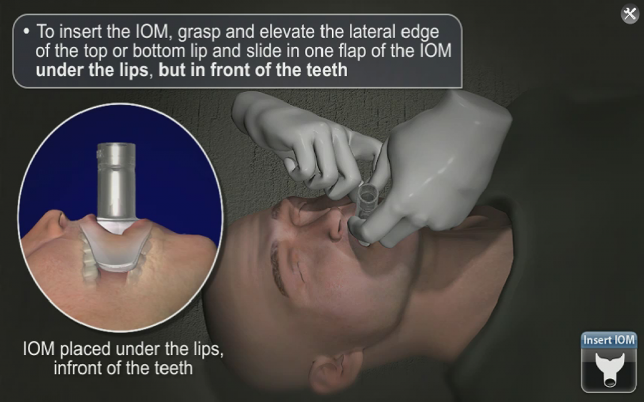 Medrills: NuMask IOM and OPA Training for EMS