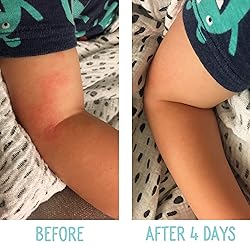 Baby and Kids Moisturizing Cream for Sensitive Skin