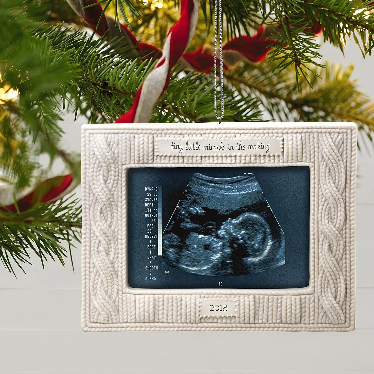 ultrasound christmas ornament