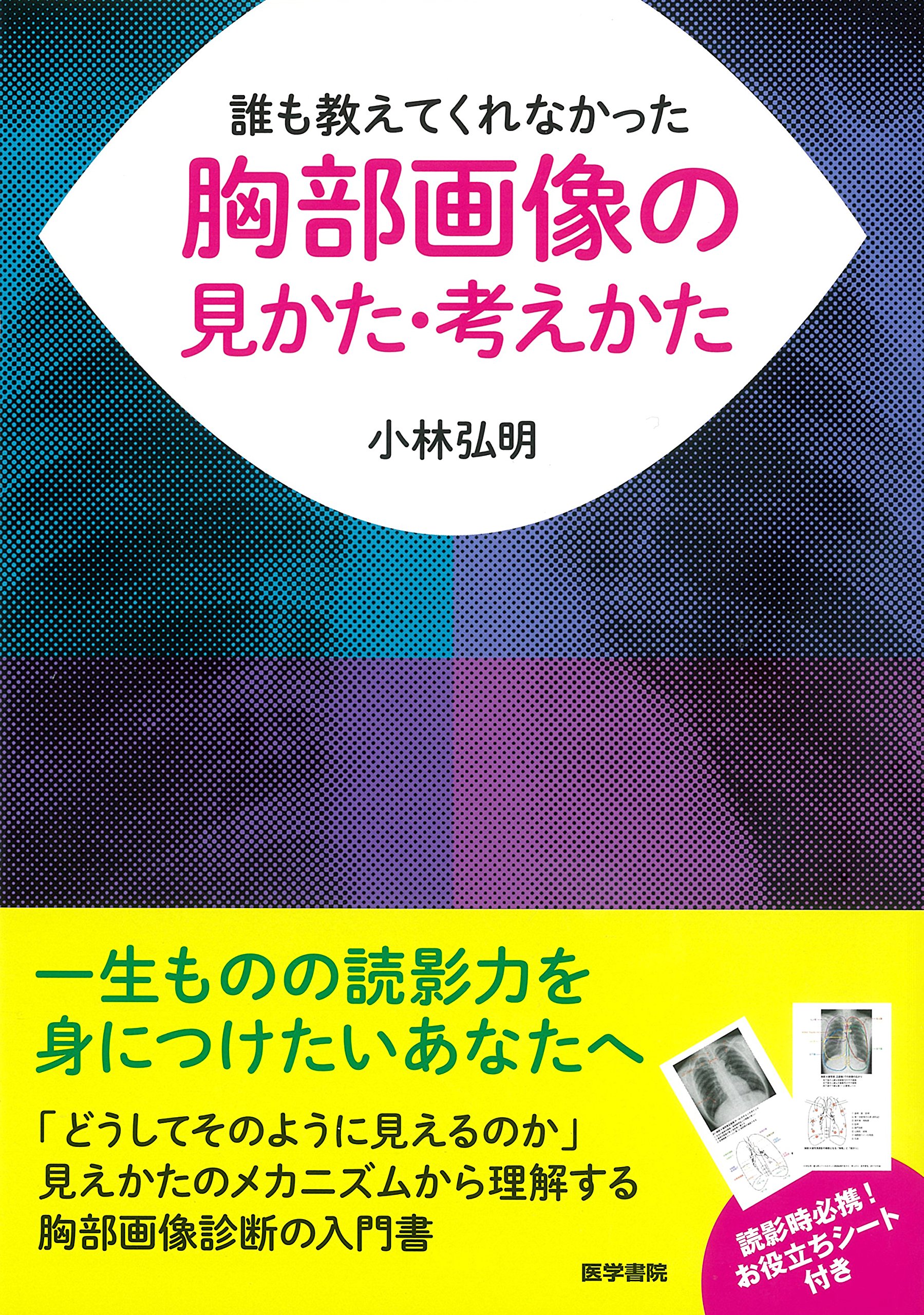 誰も教えてくれなかった胸部画像の見かた 考えかた Amazon Co Uk Books