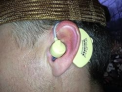 Woodland Whisper - Behind the Ear Hearing Enhancer