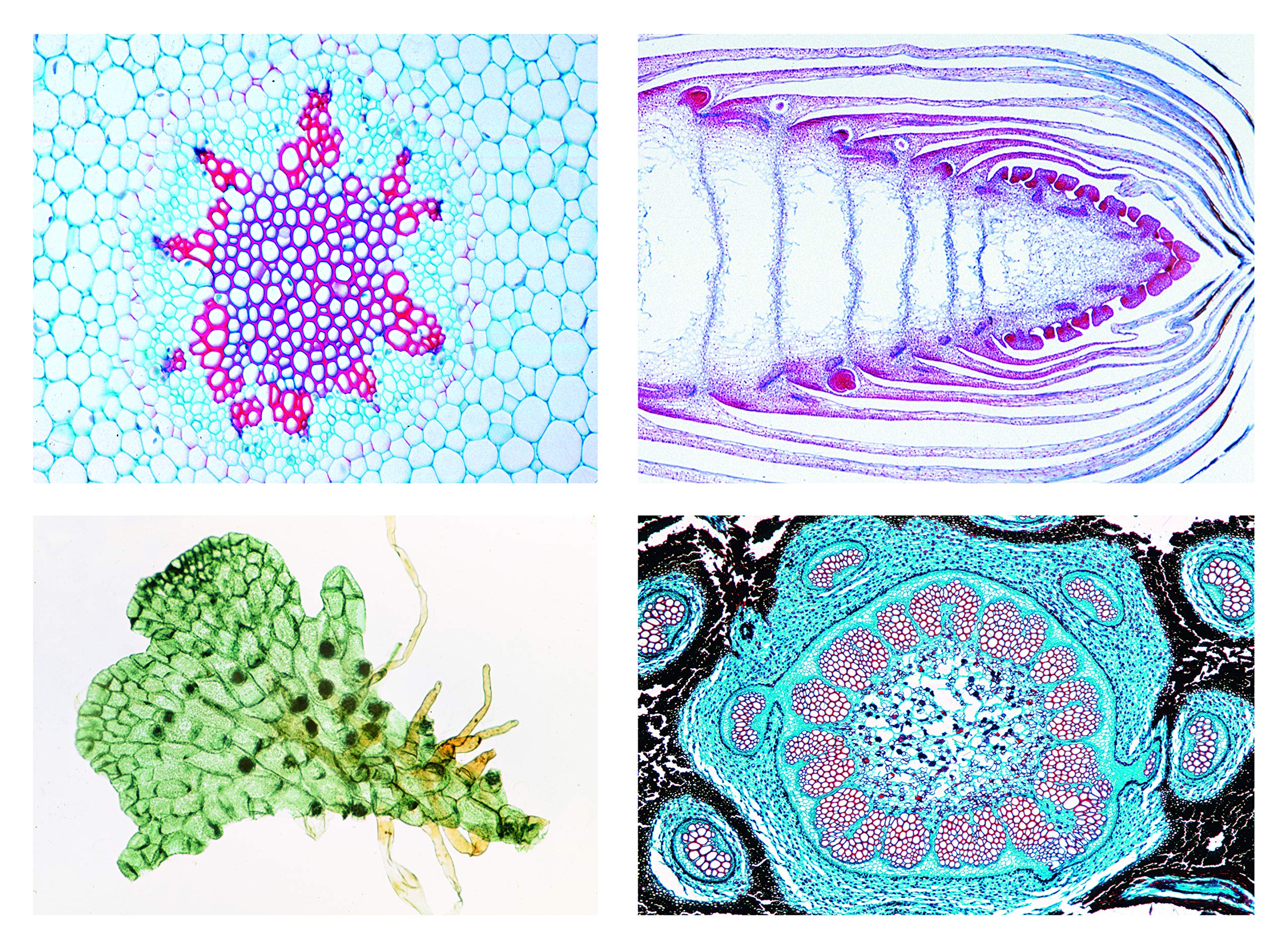 3B Scientific Biology Microscopy Micropräparates Series_ Lever and Liver Moss (Bryophyta, Marchantiophyta)