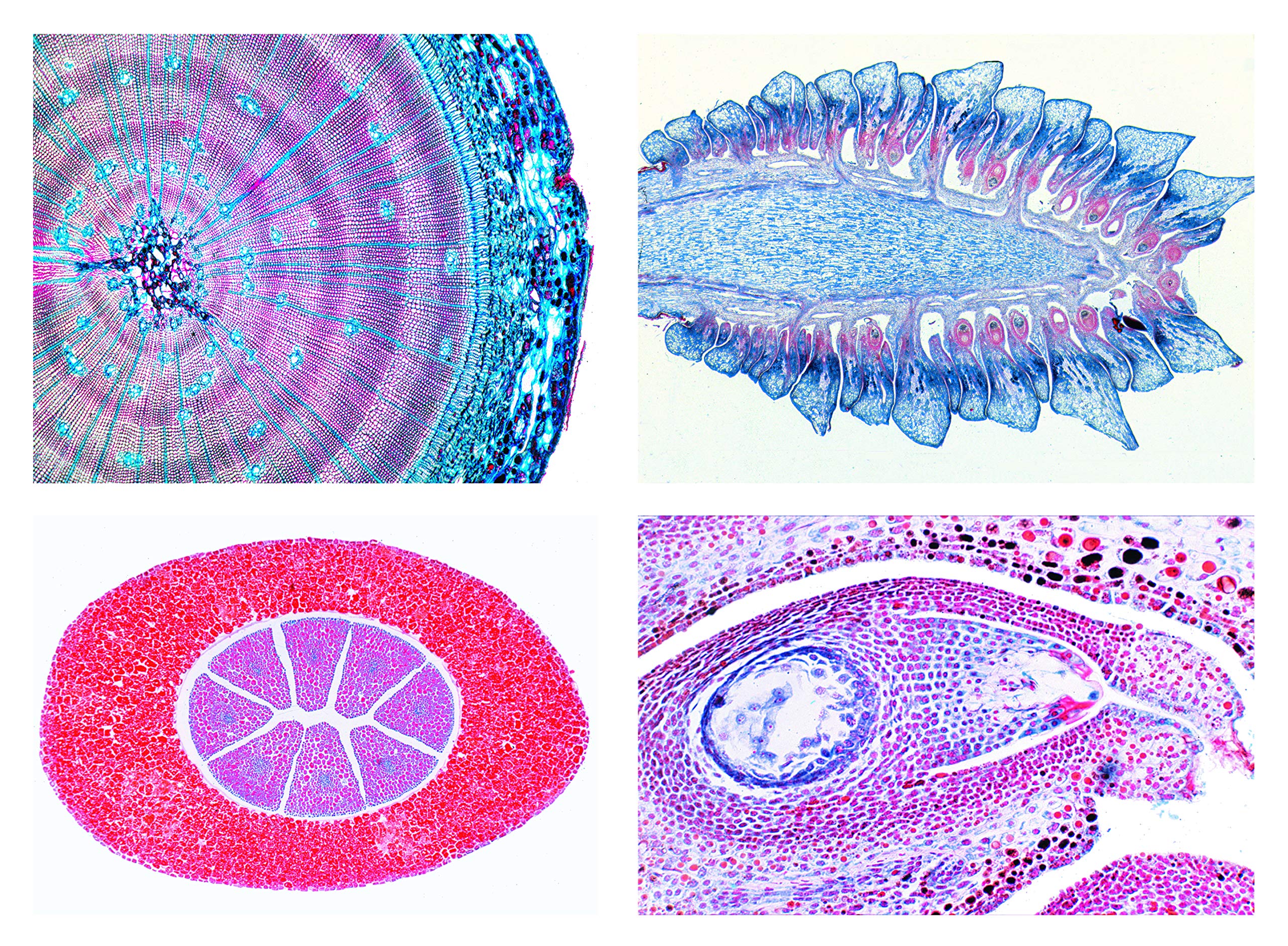 3B Scientific Biology Microscopy Micropräparate Series_ Far-like Plants (Pteridophyta)