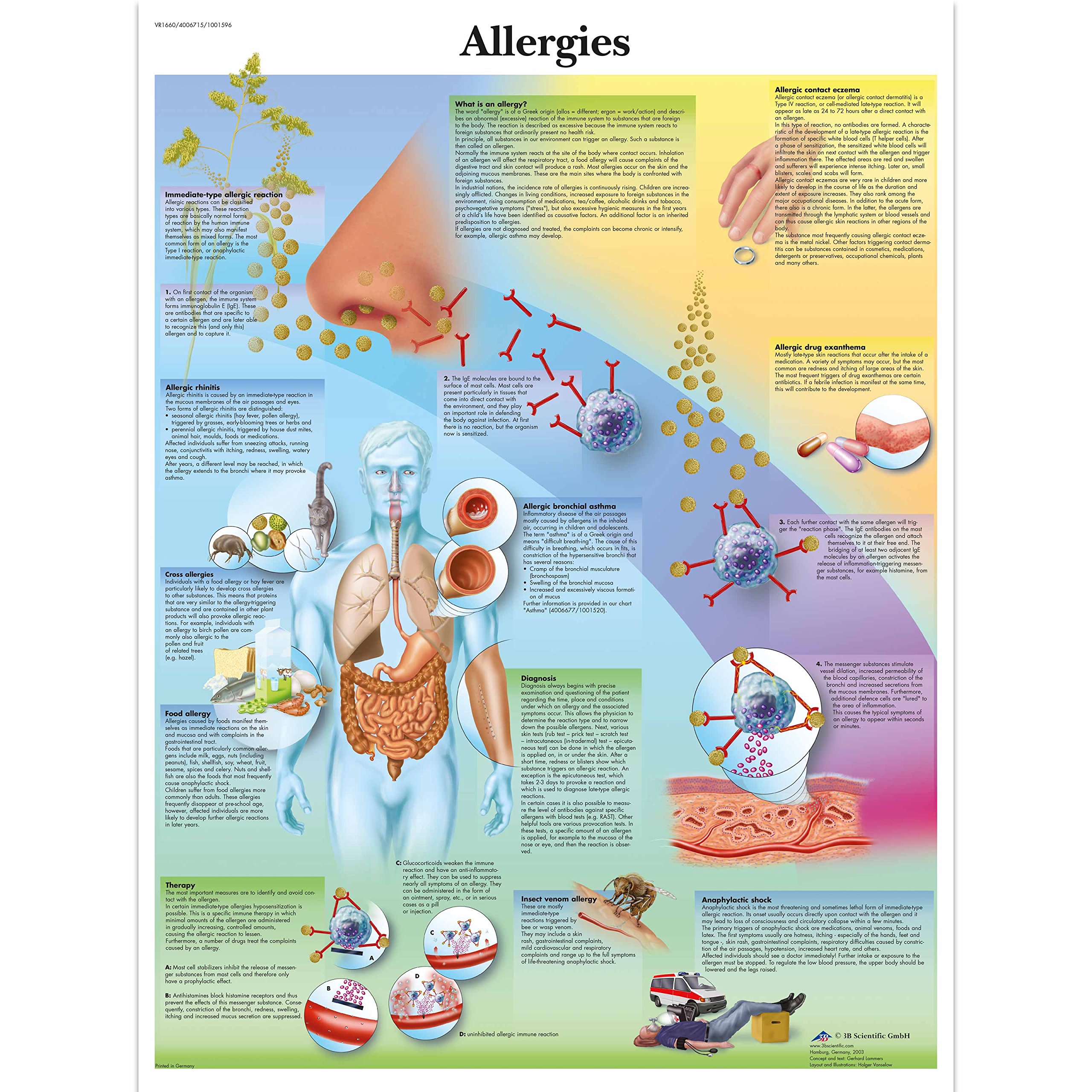 3B Scientific Human Anatomy - Allergies Chart, Paper Version