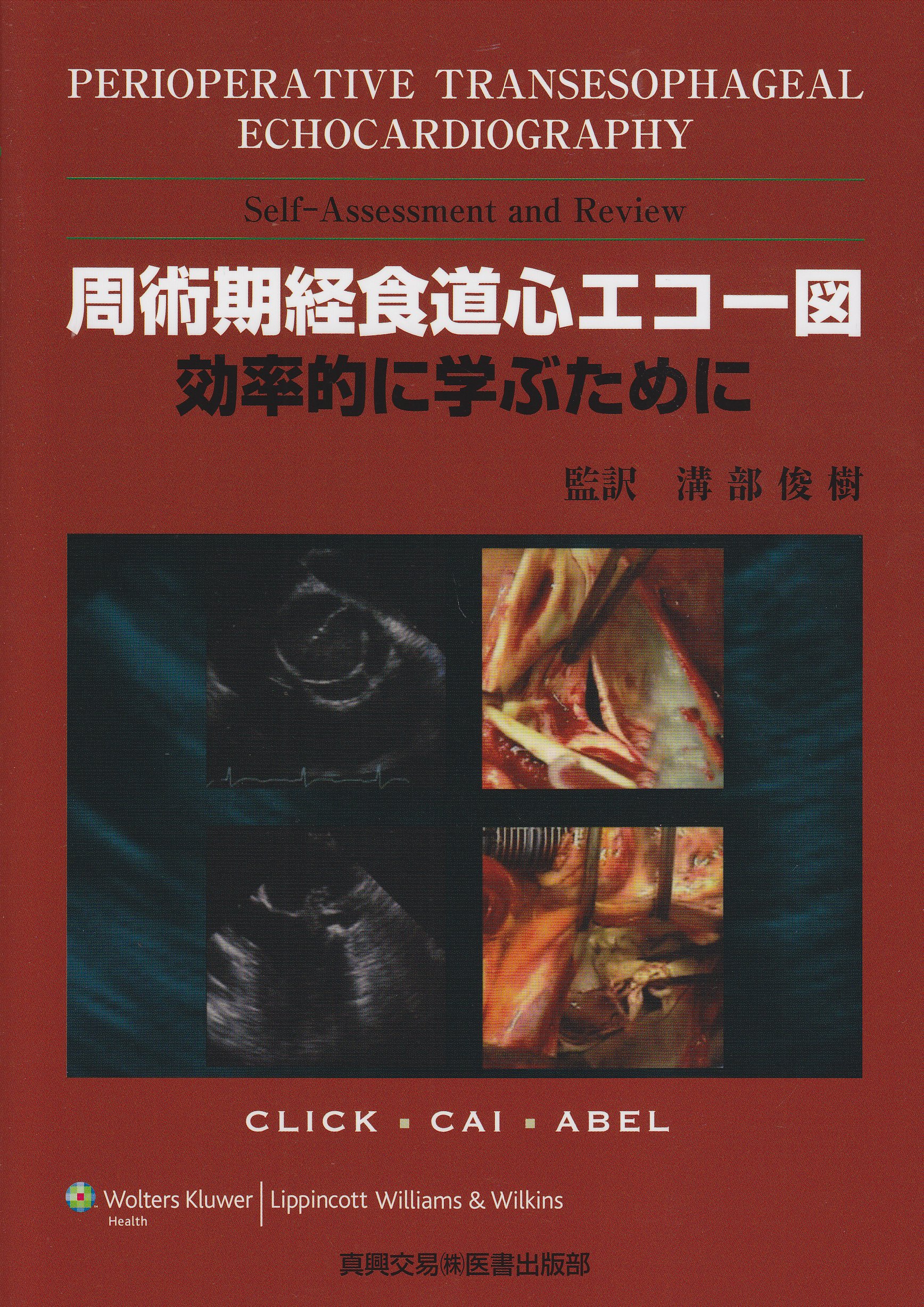 周術期経食道心エコー図 効率的に学ぶために ジョイ X ケイ ロジャー L クリック 本 通販 Amazon