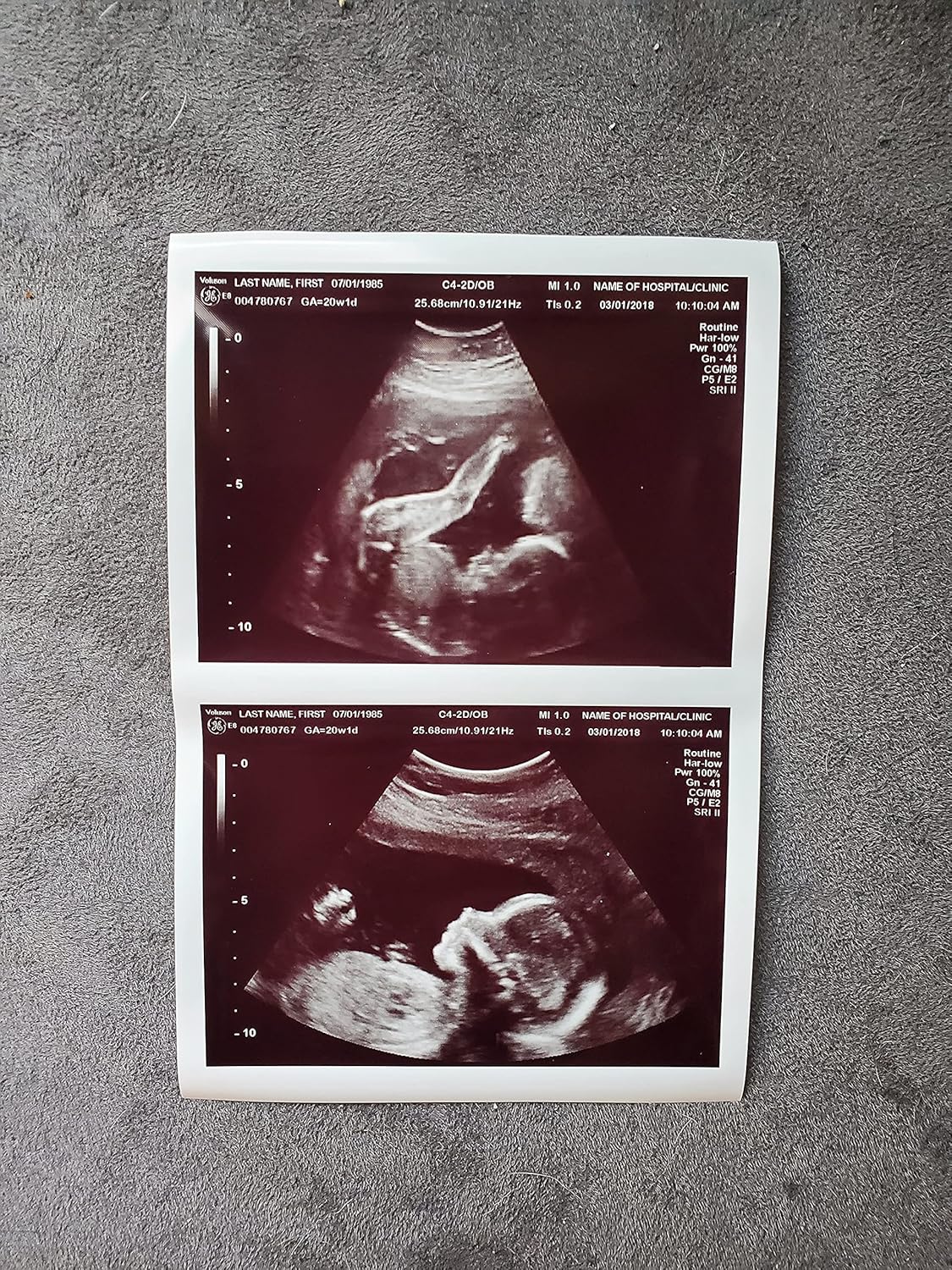 Photographs - Prank 2D Customized Fake Ultrasound TWO PHOTOS Connected B&W