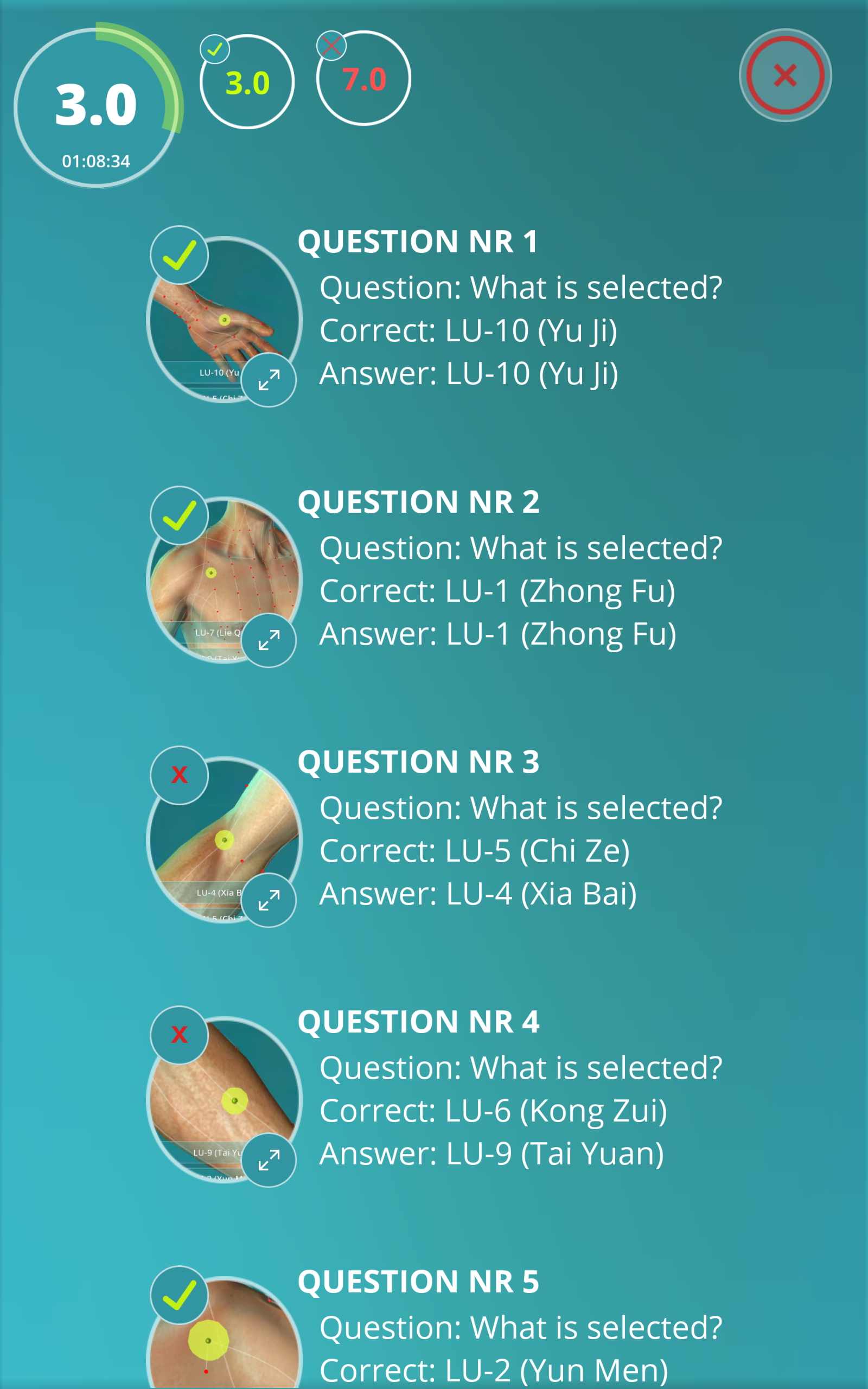 Acupuncture Quiz Point Locations on Galleon Philippines