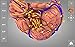 Brain - 3D Atlas of Anatomy