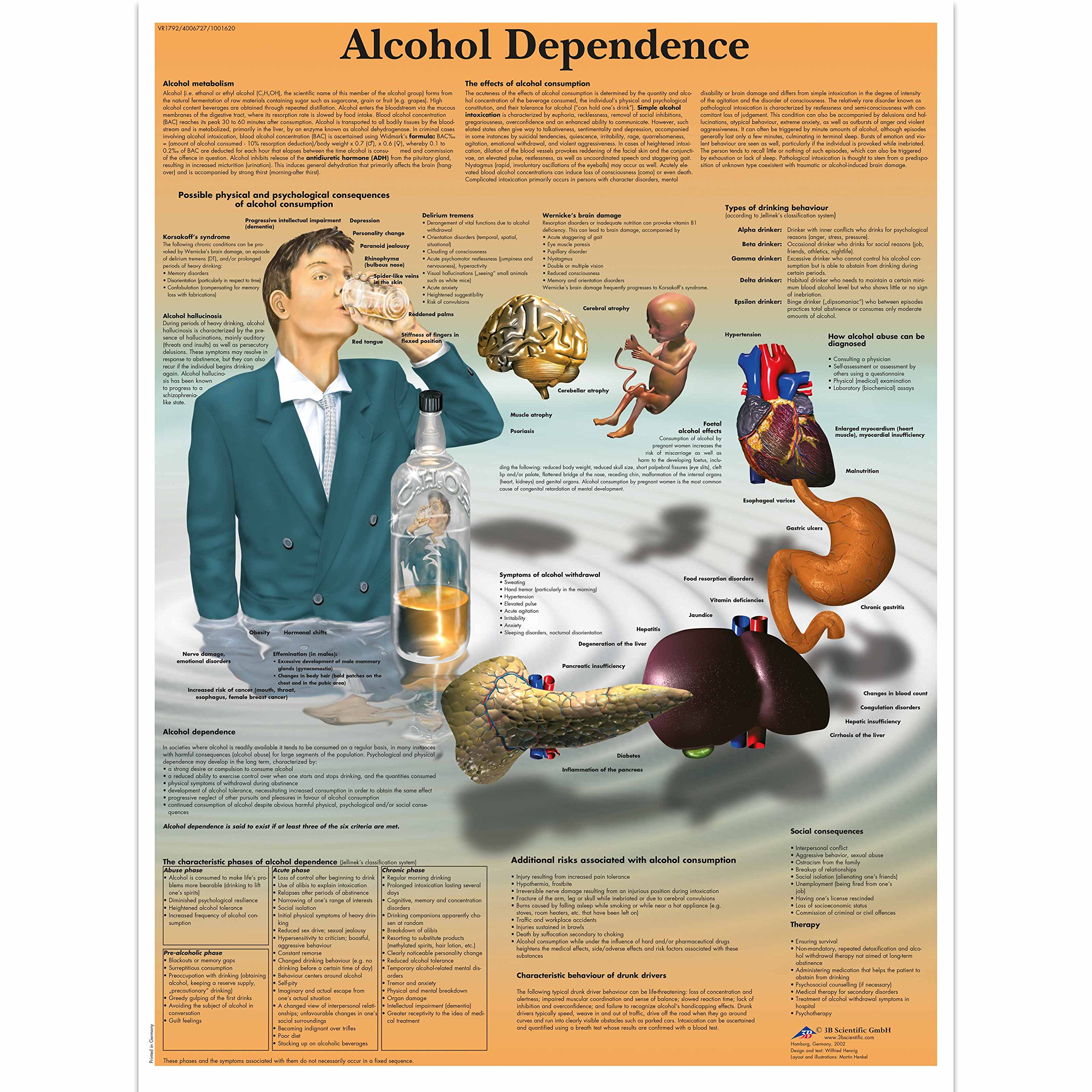 3B Scientific Human Anatomy - Alcohol Dependence Chart, Paper Version