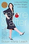 Before & After, Revised Edition: Living and Eating Well After Weight-Loss Surgery