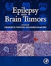 Epilepsy and Brain Tumors