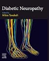 Diabetic Neuropathy