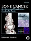 Bone cancer : bone sarcomas and bone metastases - from bench to bedside