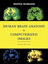 Human Brain Anatomy in Computerized Images