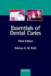 Essentials of Dental Caries: The Disease and Its Management