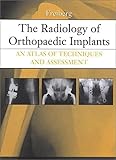 The Radiology Of Orthopaedic Implants An Atlas Of Techniques And Assessment