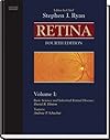 Retina