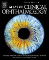 Atlas of clinical ophthalmology