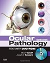 Ocular Pathology