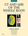 CT and MRI of the Whole Body, 2-Volume Set