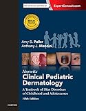 Hurwitz Clinical Pediatric Dermatology A Textbook Of Skin Disorders Of Childhood And Adolescence