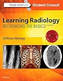 Learning Radiology Recognizing The Basics