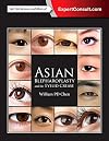 Asian Blepharoplasty and the Eyelid Crease, 3e