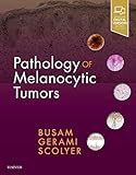 Pathology Of Melanocytic Tumors