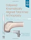 Calipered kinematically aligned total knee arthroplasty : theory, surgical techniques and perspectives