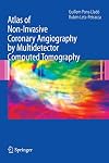 Atlas of Non-Invasive Coronary Angiography by Multidetector Computed Tomography (Developments in Cardiovascular Medicine)