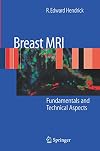 Breast MRI: Fundamentals and Technical Aspects