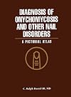 Diagnosis of onychomycosis and other nail disorders : a pictorial atlas