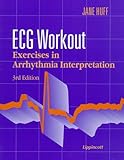 Ecg Workout Exercises In Arrhythmia Interpretation
