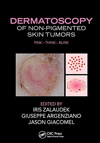 Copertina: Dermatoscopy of Pediatric Skin Tumors