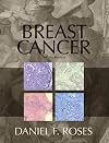 Breast Cancer, 2e