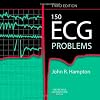 150 ECG Problems