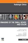 Imaging of the Small Bowel and Colon, An Issue of Radiologic Clinics of North America (Volume 63-3) (The Clinics: Radiology, Volume 63-3)