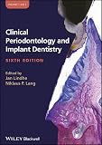 Clinical Periodontology And Implant Dentistry 2 Volume Set
