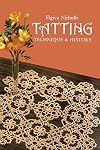 Tatting: Technique and History