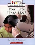 You Have Head Lice Rookie Readabout Health
