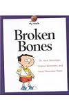 Broken bones