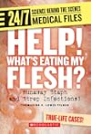 Help! What's Eating My Flesh?: Runaway Staph and Strep Infections!