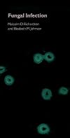 The Pocket Guide to Fungal Infection