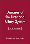 Diseases of the liver and biliary system