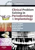 Clinical Problem Solving In Periodontology And Implantology